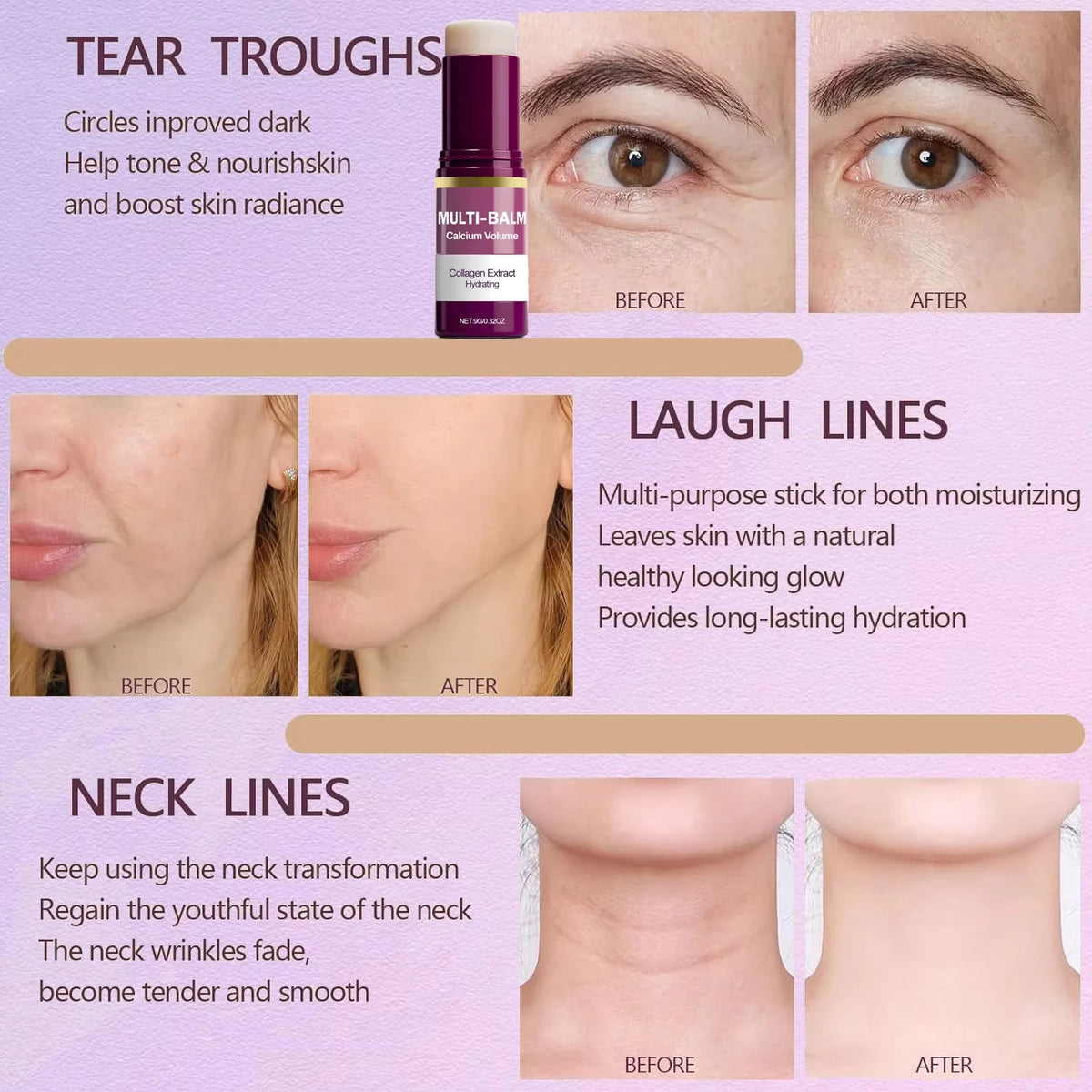 Hoygi Calcium Firming Balm Stick for Face Neck and Eyes