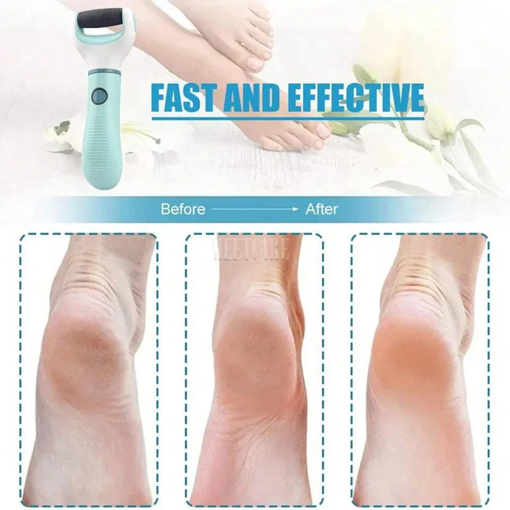Foot File Scraper For Callus Removal And Dead Skin Care