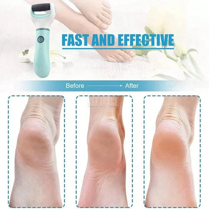 Foot File Scraper For Callus Removal And Dead Skin Care